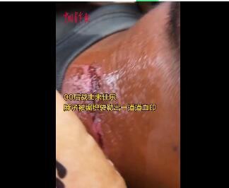 抗洪戰(zhàn)士疼得直叫依然說(shuō)沒(méi)事兒 現(xiàn)場(chǎng)圖曝光令人鼻酸