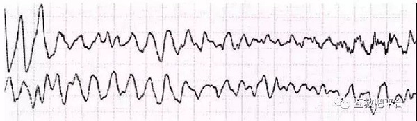 救命神器AED有多重要——你認(rèn)識它嗎？(圖5)
